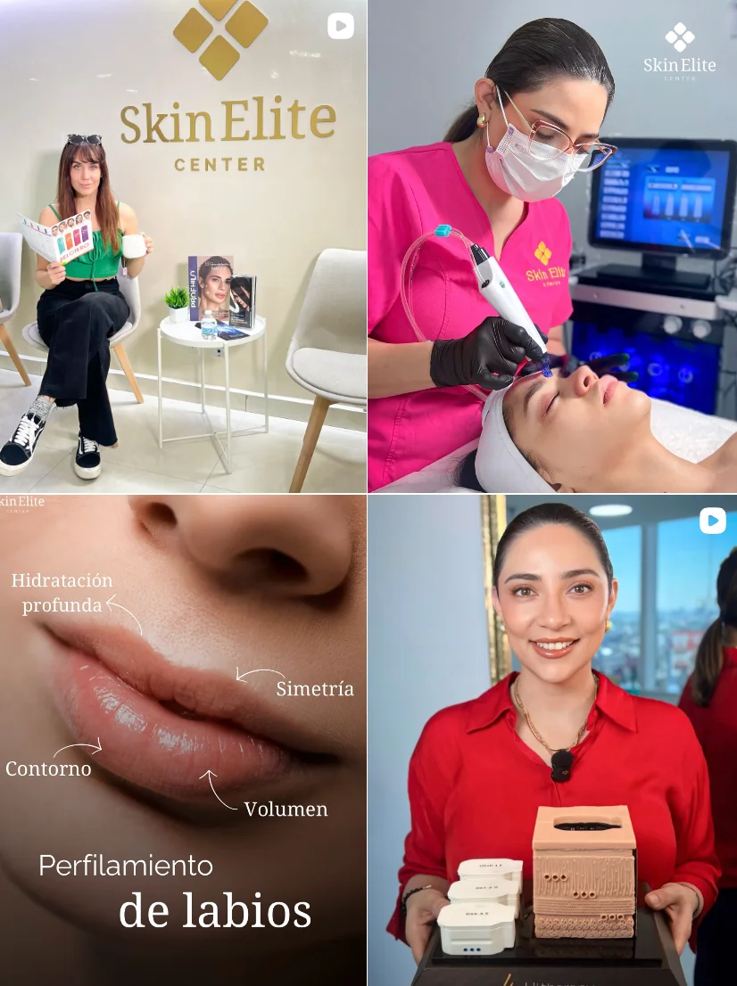 Skin Elite en Instagram