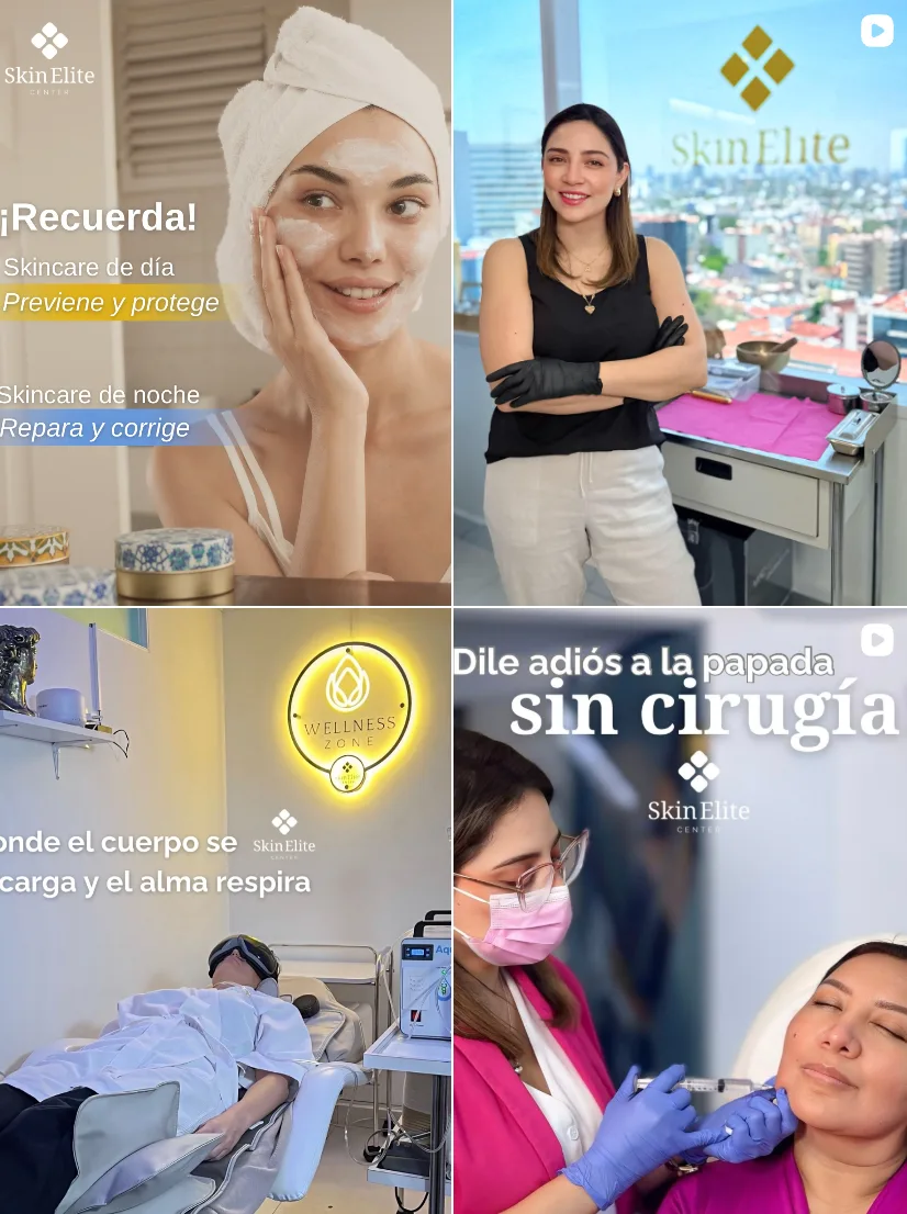 Skin Elite en Instagram