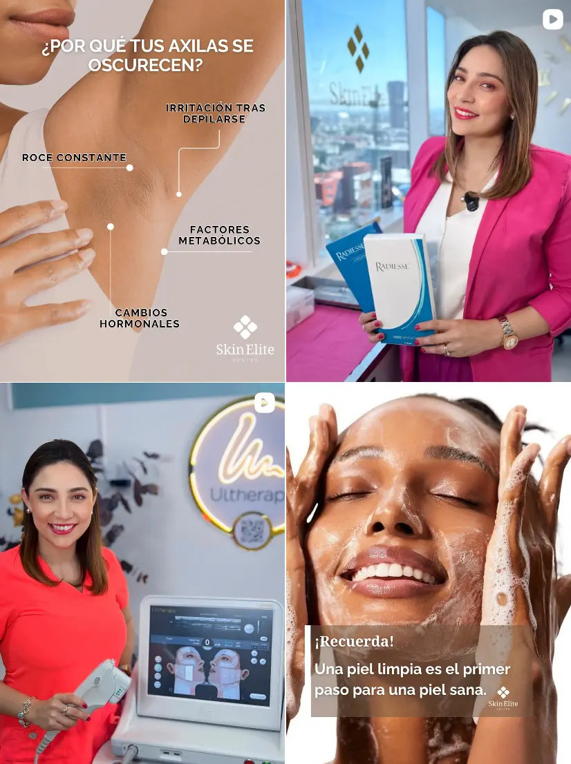 Skin Elite en Instagram