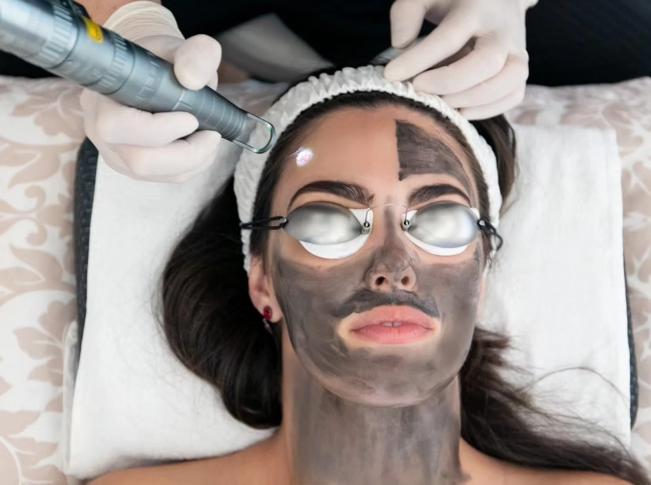 Hollywood Peel